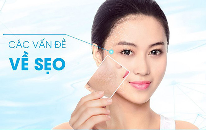 Dịch vụ SEO Spa